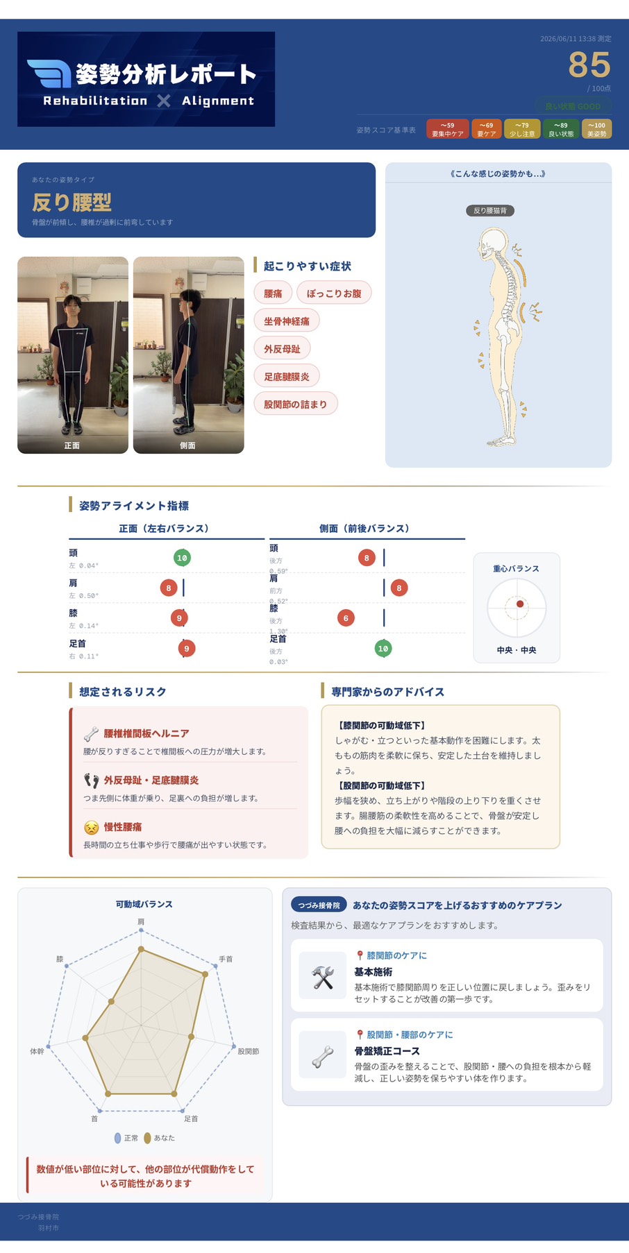 姿勢分析レポートのサンプル